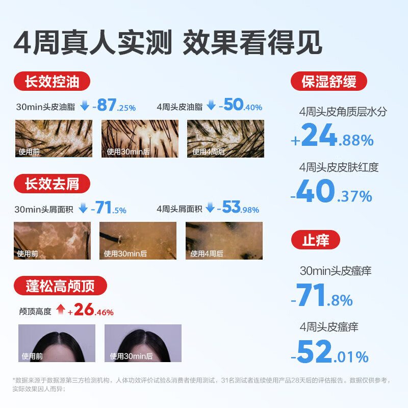 红色小象青少年去屑洗发水深层洁净控油学生女孩男大童洗发乳蓬松清爽止痒 【青少年专研】洗发水400g