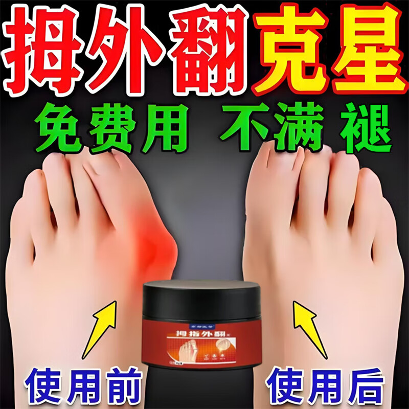 拇指外翻贴膏拇指外翻矫正器拇指疼痛变形重叠大脚骨突出拇指外翻 【中度拇指外翻】买三送二/5瓶 京东折扣/优惠券