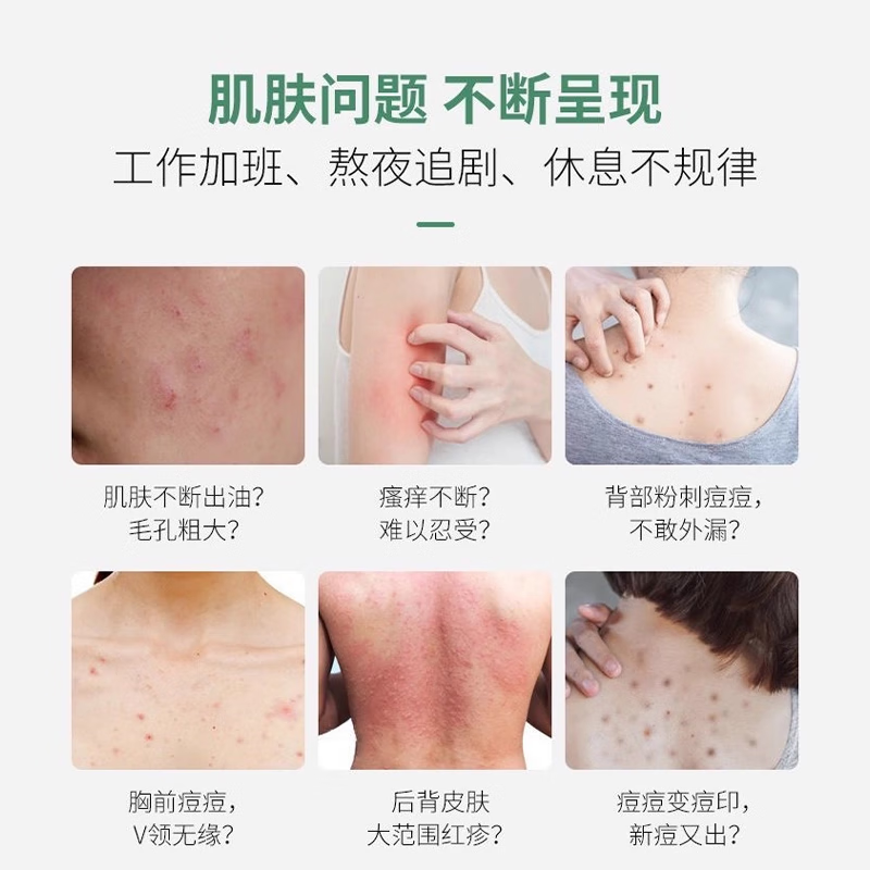 【日本炉甘石】特效皮肤瘙痒止痒洗剂洗澡皂沐浴全身体适用天然 买5送5【重度止痒】