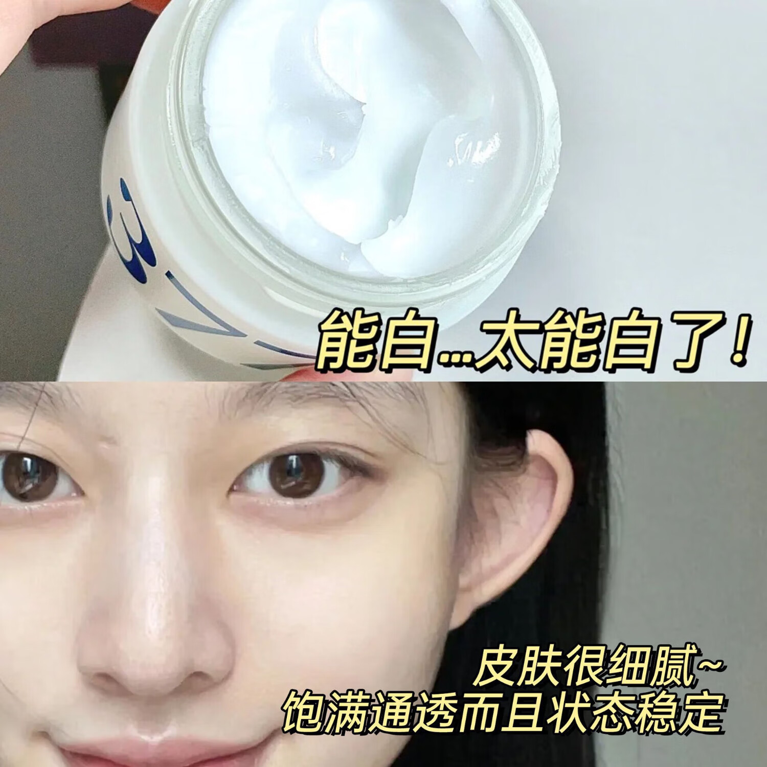 欧丽琦祛斑霜面霜乳液烟酰胺凝胶祛斑霜美白淡化老年黄褐雀斑黑色素 377祛斑霜50g