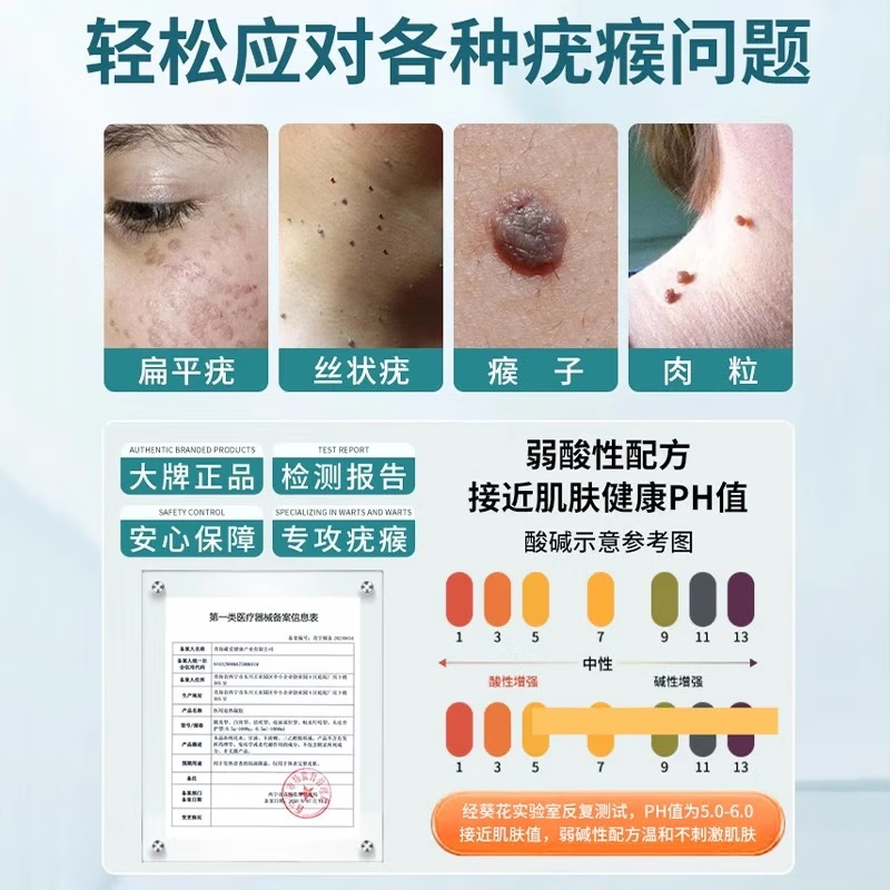 葵花祛疣凝胶去除疣体药膏丝状疣丝状疣脖子颈部扁平疣疣体脱落膏专用 特效一盒装【疣猴灵膏】