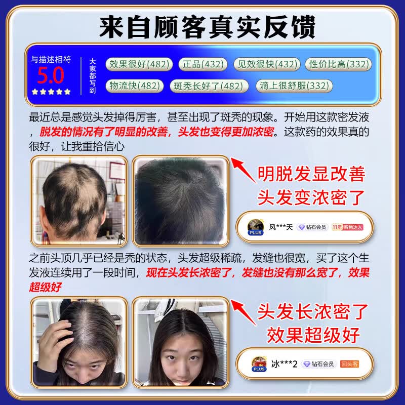 岩井昃弘日本斑秃外用脱掉发严重鬼剃头专用快速生发液日本进口斑秃100%药 100%特效：三盒【升级进口配方】