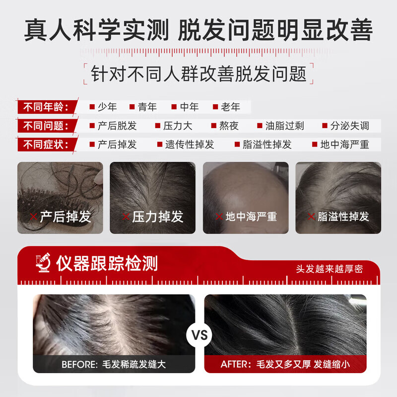 三个魔发匠防脱洗发水生姜固发可比落侧柏叶育控油去屑洗头膏男女士第1 可比落防脱 400ml*1瓶