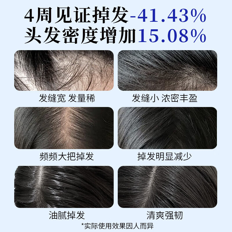 EHD防脱洗发水强韧健发洗发露滋润柔顺滑蓬松控清爽不油丝滑男女通用 防脱 300ml*1瓶 +蓬松100ml*2