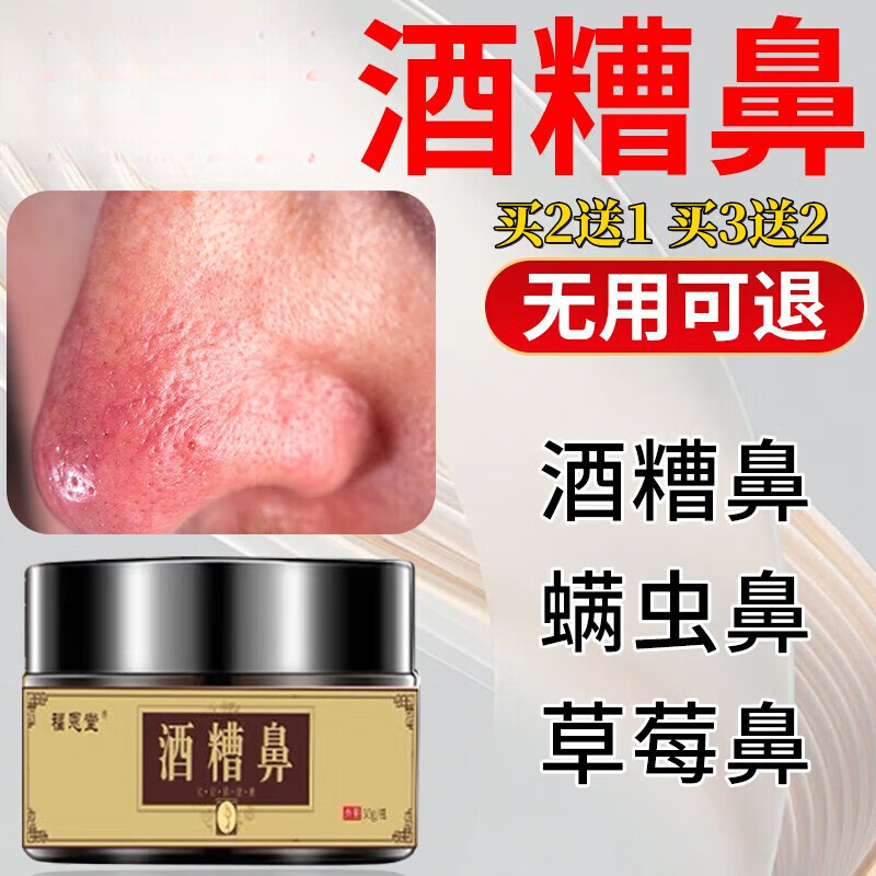 红鼻子酒糟鼻专用去黑头粉刺螨虫鼻头红血丝乳膏修复缓解鼻部酒渣鼻膏