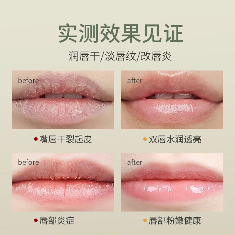 LIFUSHA芦荟唇膏保湿滋润嘴唇男女士专用补水修护干裂死皮秋冬护唇膏 芦荟唇膏2.7g 3支