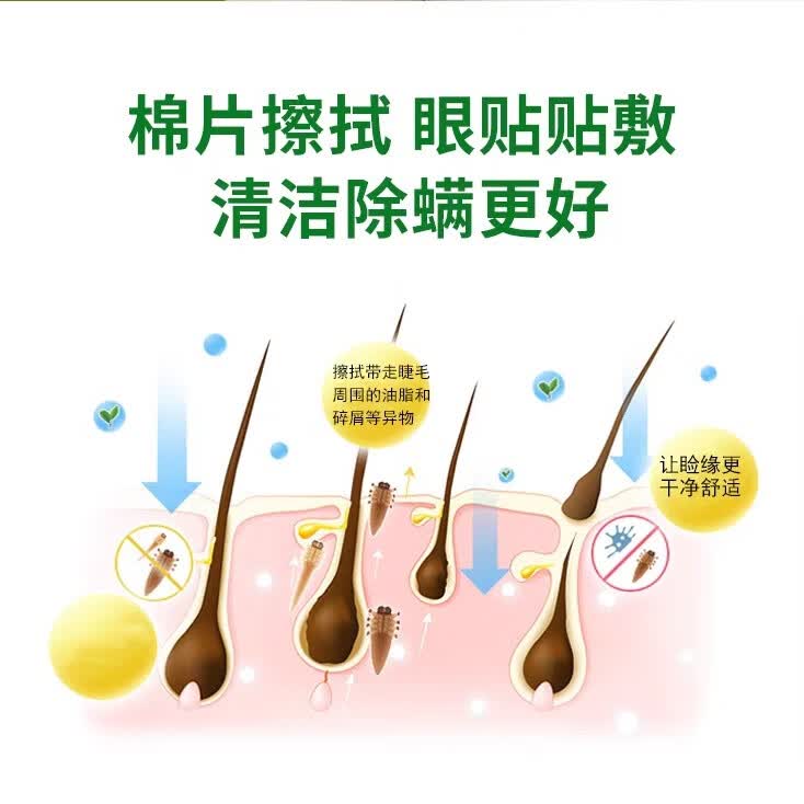 加视利加视利巾四松醇眼部清洁湿巾除螨虫14片装 4松油醇除螨湿巾 1片*14袋