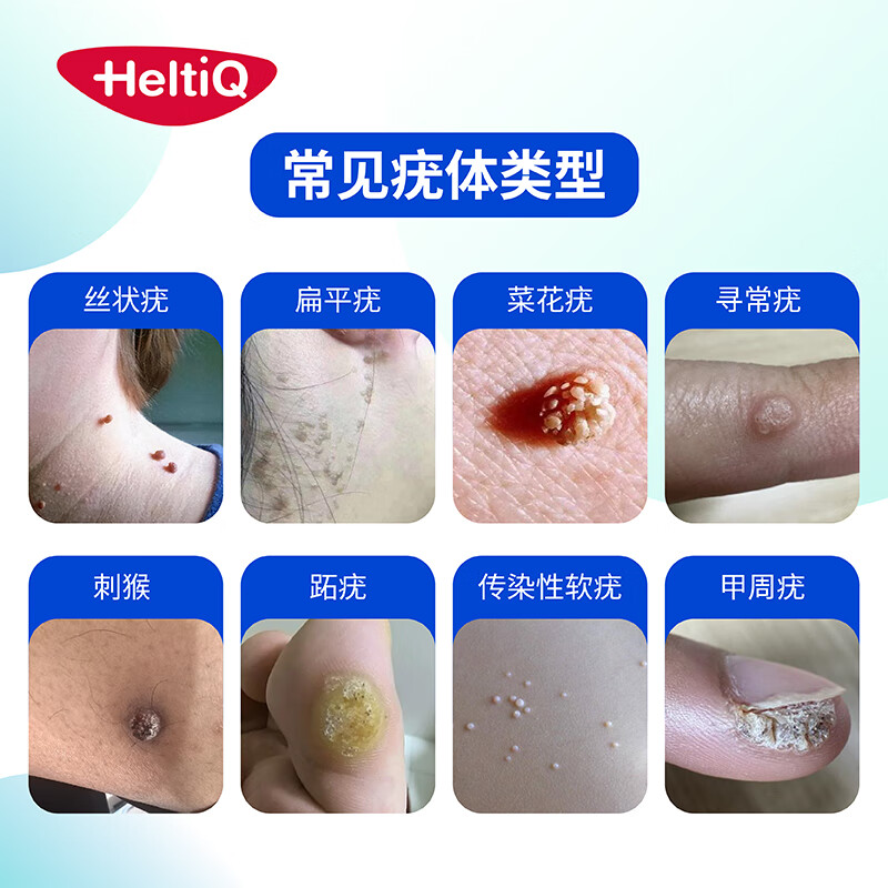 荷迪优冷冻除疣喷雾剂去疣喷剂丝状疣扁平疣跖疣湿疣菜花医用冷冻疣38ml 1盒38ml【丝状疣皮赘软疣可冷冻15-20颗】