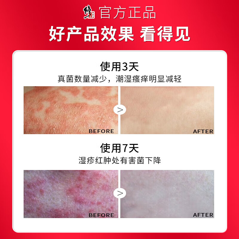 修正阴囊潮湿瘙痒阴囊炎睾丸瘙痒湿疹膏肛门大腿内侧皮肤瘙痒止痒男性 三套实惠周期装（适于中重度型） 阴囊湿疹潮湿瘙痒男人专用止痒去根