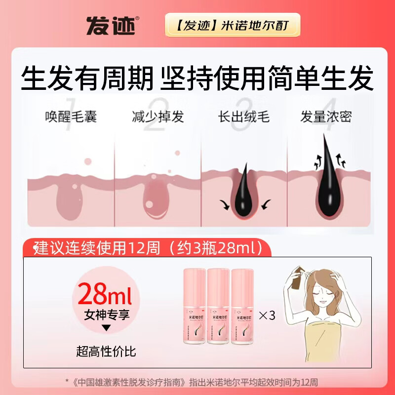 发迹 米诺地尔酊生发喷雾5%浓度28ml 男女性防脱发生发育发液 脱发严重专用 快速生发 增长发际线 【女士单瓶装】28ml*1瓶