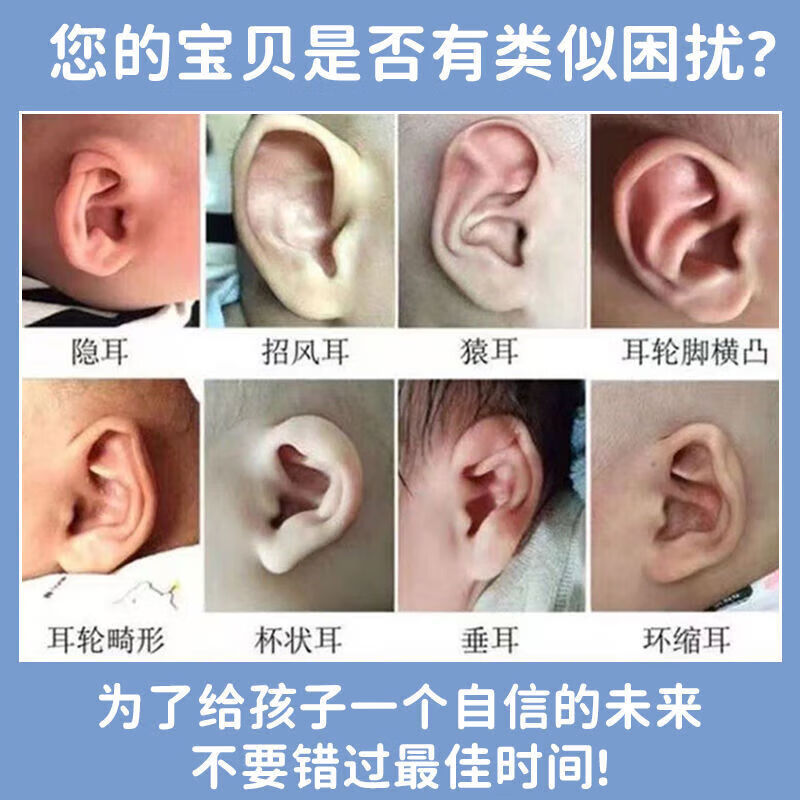 通用耳朵器婴儿硅胶耳朵器耳廓矫形新生儿畸形耳型垂耳纠正 耳撑[一对]+胶卷
