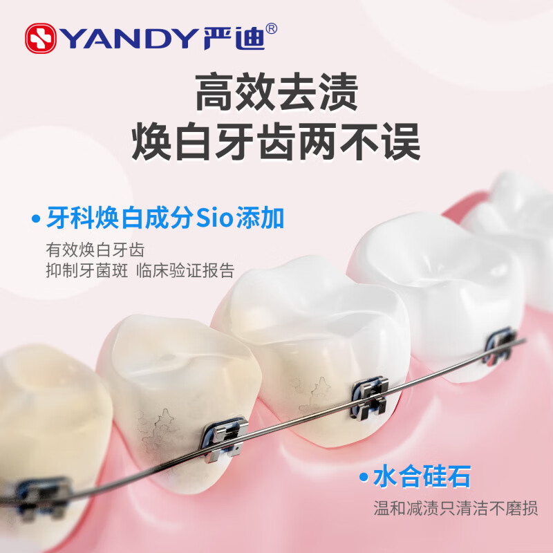 含氟正畸专用牙膏戴牙套成人牙齿美白护齿防蛀脱矿青少年 2支110g低氟1000ppm【基础】