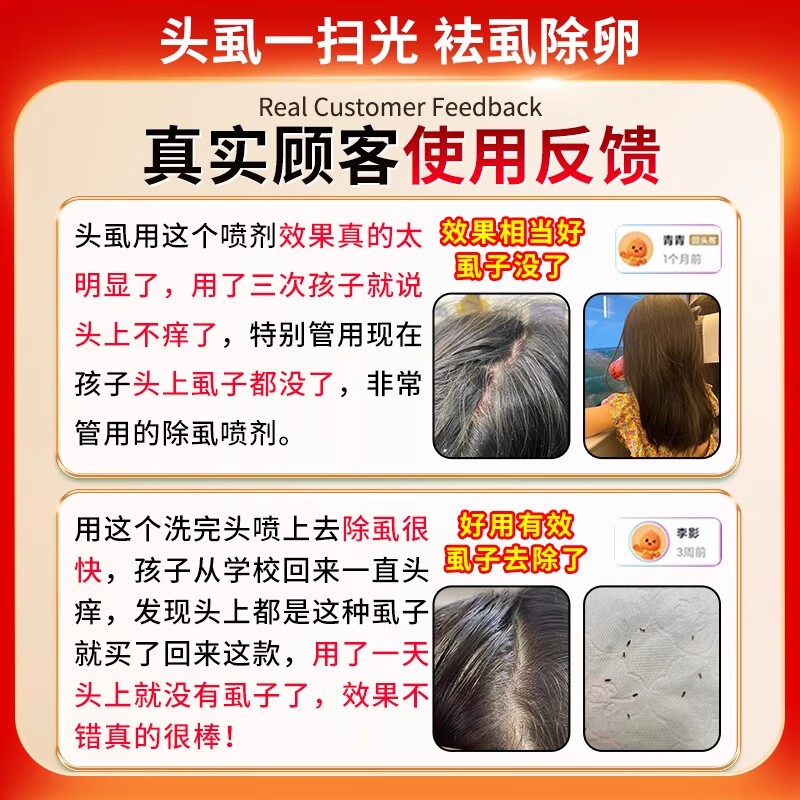 虱子药儿童头虱虱卵一扫光百部酊去头虱小女孩头发去除虱卵虱立净 1盒【60ml】一喷去虱