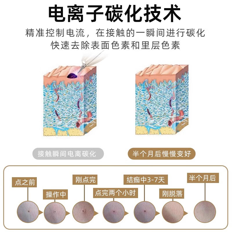 DIKTT【德国】扫斑去斑点痣笔2025新款小白激光祛斑美容院用点痔去痣点斑笔美容仪器女士女生节日礼物 玫瑰金【旗舰款-带防伪】9档蓝光修复+15重豪礼 旗舰