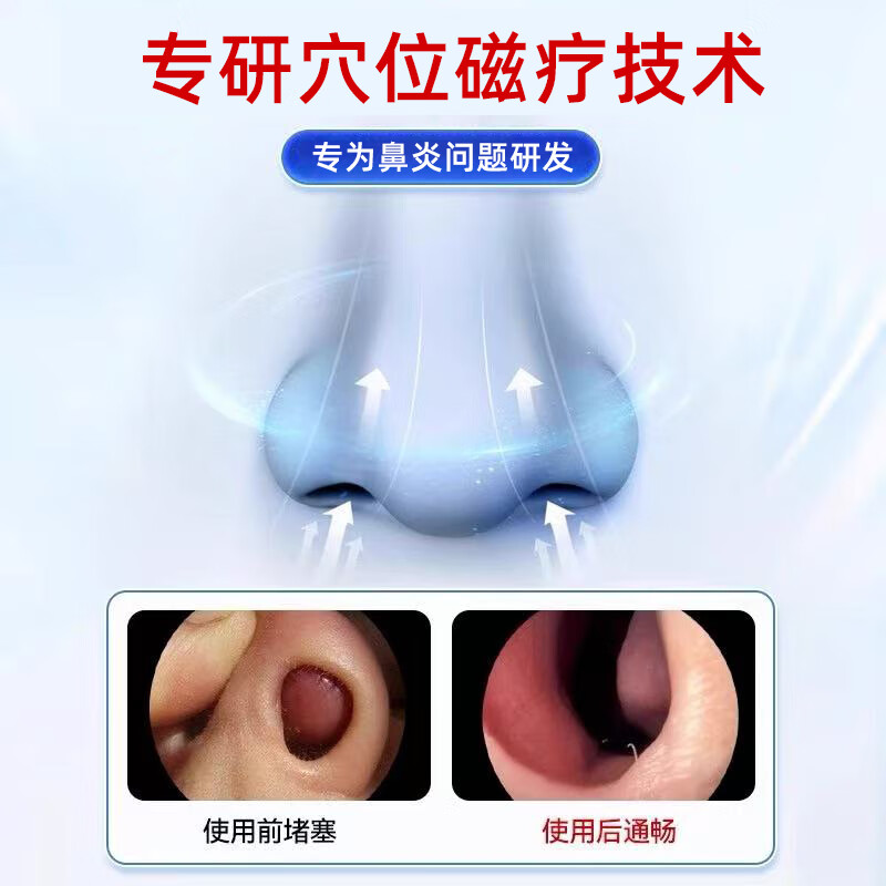 呼必安穴位磁疗贴鼻炎鼻塞过敏性鼻炎通气鼻贴成人儿童鼻炎贴官方正品 一盒【体验装】推荐多盒装效果好