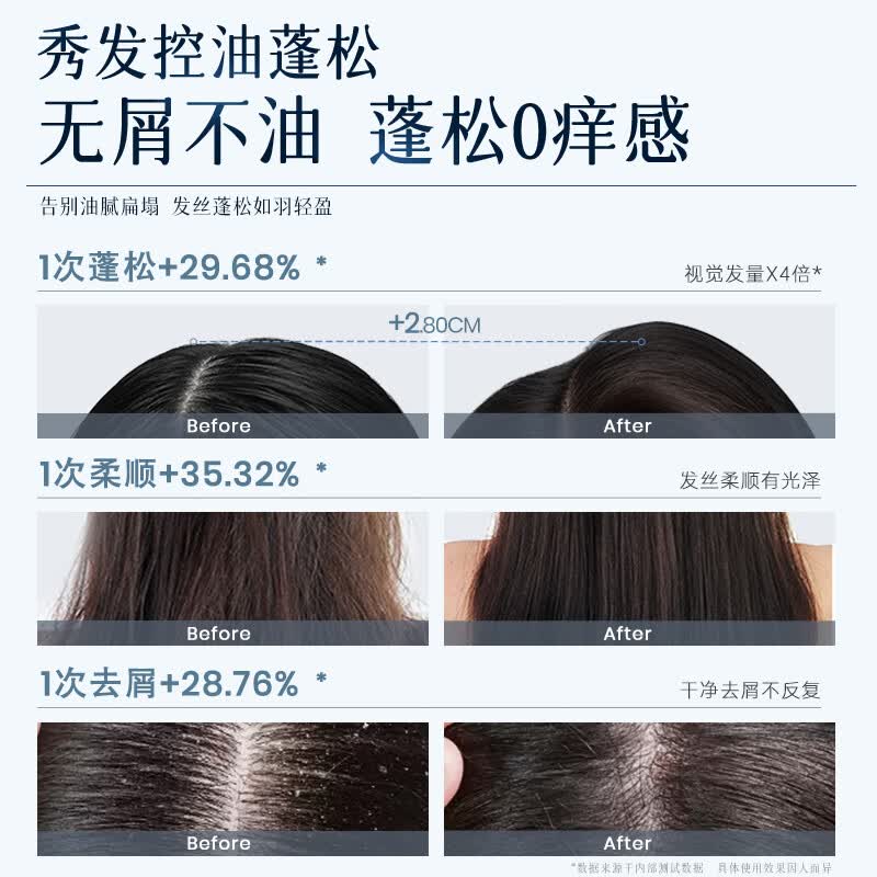 紫郁洗发水沐浴露套装去屑止痒控油蓬松洗头膏露持久留香柔顺男女 【控油蓬松】控油洗330g+玫瑰花瓣沐200g