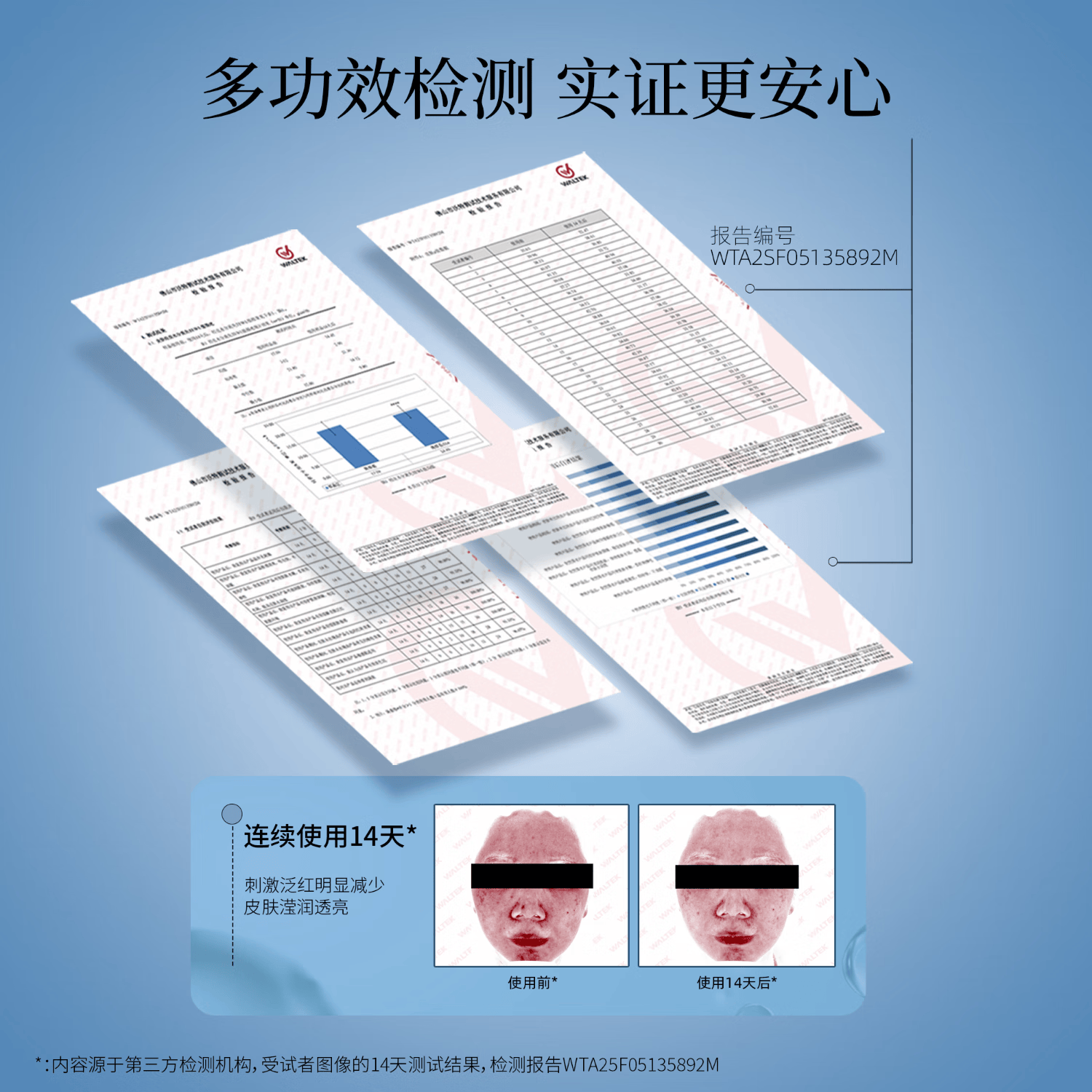 奕森氨甲环酸修护精华 退红淡色沉修护敏感肌舒缓褪红保湿传明酸
