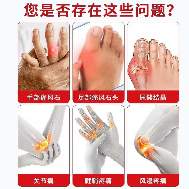 康信药业医用远红外治疗凝胶制药手指消肿止痛膏药肿胀痛风石结官方旗舰正品最新款 1支体验装