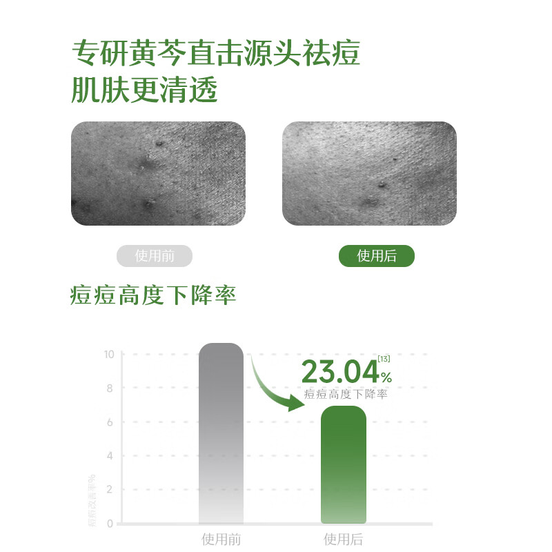 松达青少年洗面奶学生党青春期男女孩控油祛痘温和黄芩洁面泡泡 【千人复购】黄芩祛痘洁面150ml
