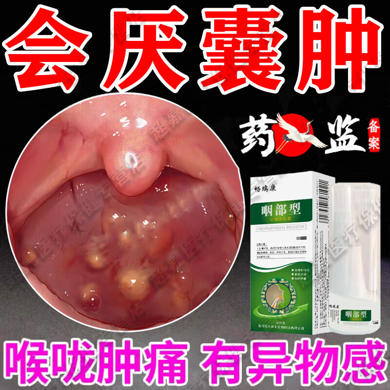 会厌囊肿专用喷雾剂中药咽喉慢性咽炎喉咙有痰肿痛滤泡