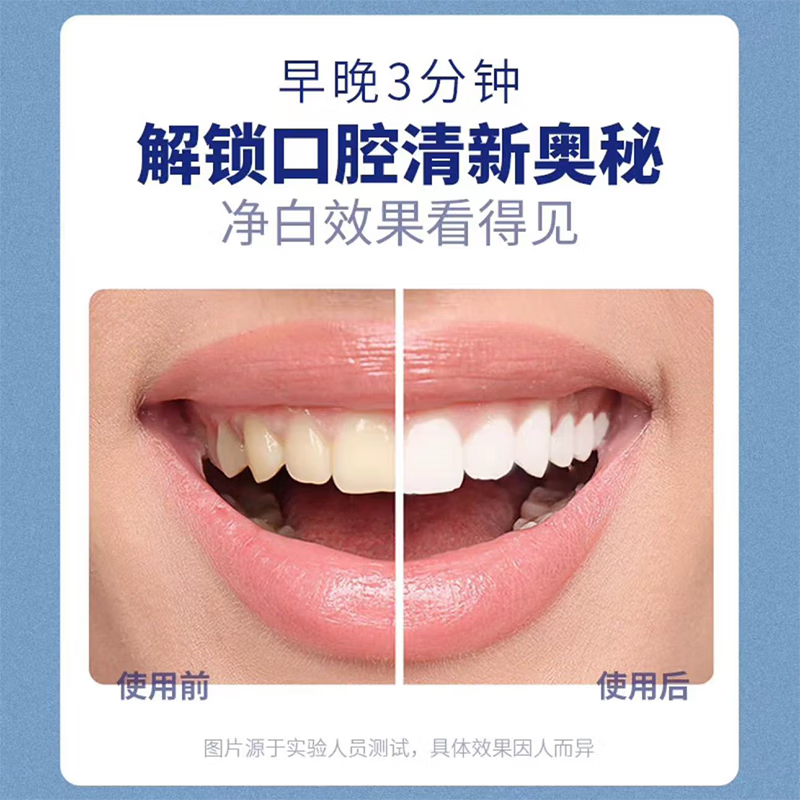 香港大药房牙膏抑菌除口臭口气重嘴巴臭口有异味难闻去黄去牙渍结石去牙渍去 买五送五【一次买够-想臭都难】