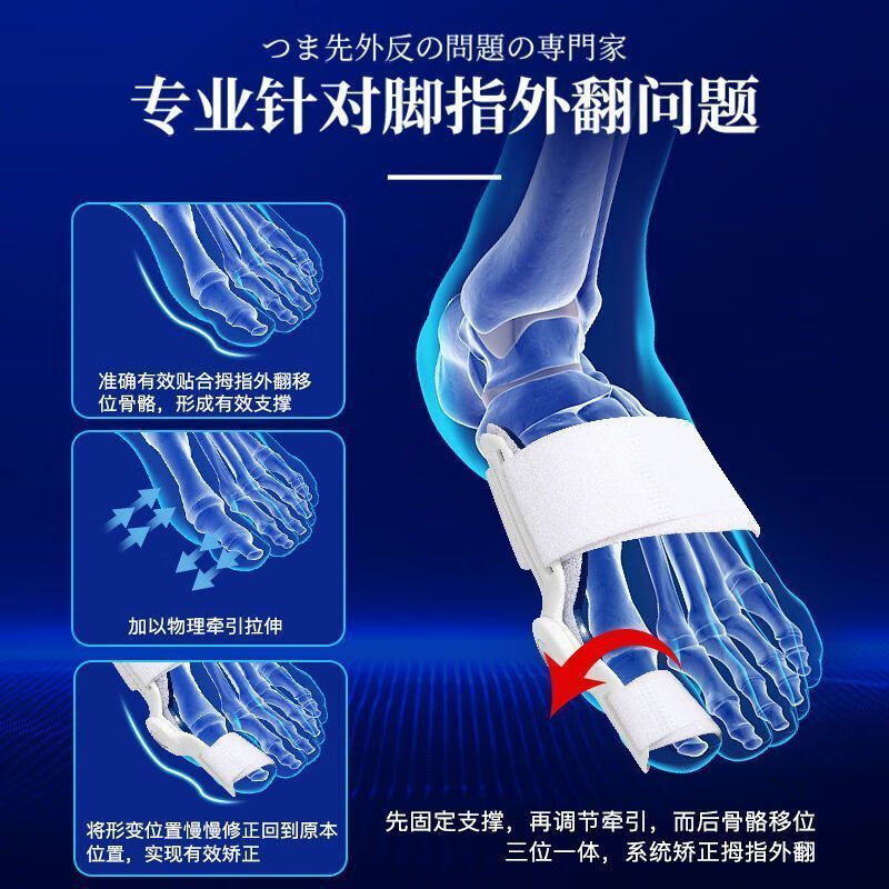 通用【德国研发】脚趾器可调节脚拇指外翻分趾器男女大脚骨效正器  不 【组合搭配】日用辅助+夜用强力