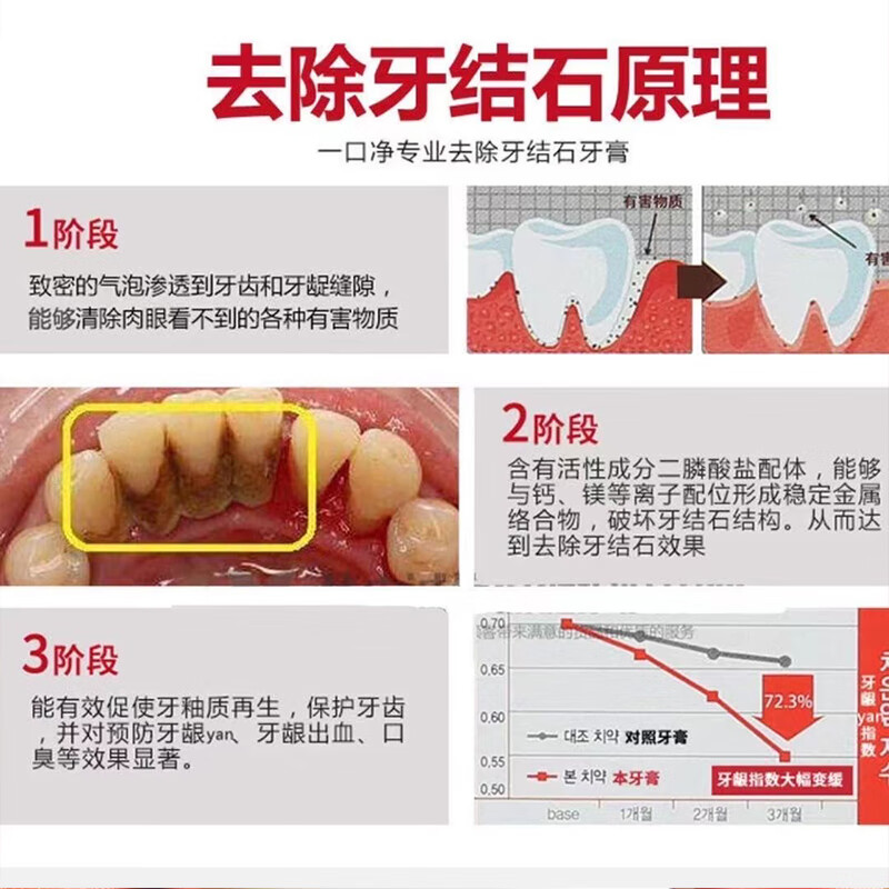 一口净（WholeClean）去牙结石牙膏溶解牙石速效专用去除渍清理牙垢去黄美白烟渍成年人 【旅行装】30克*2支