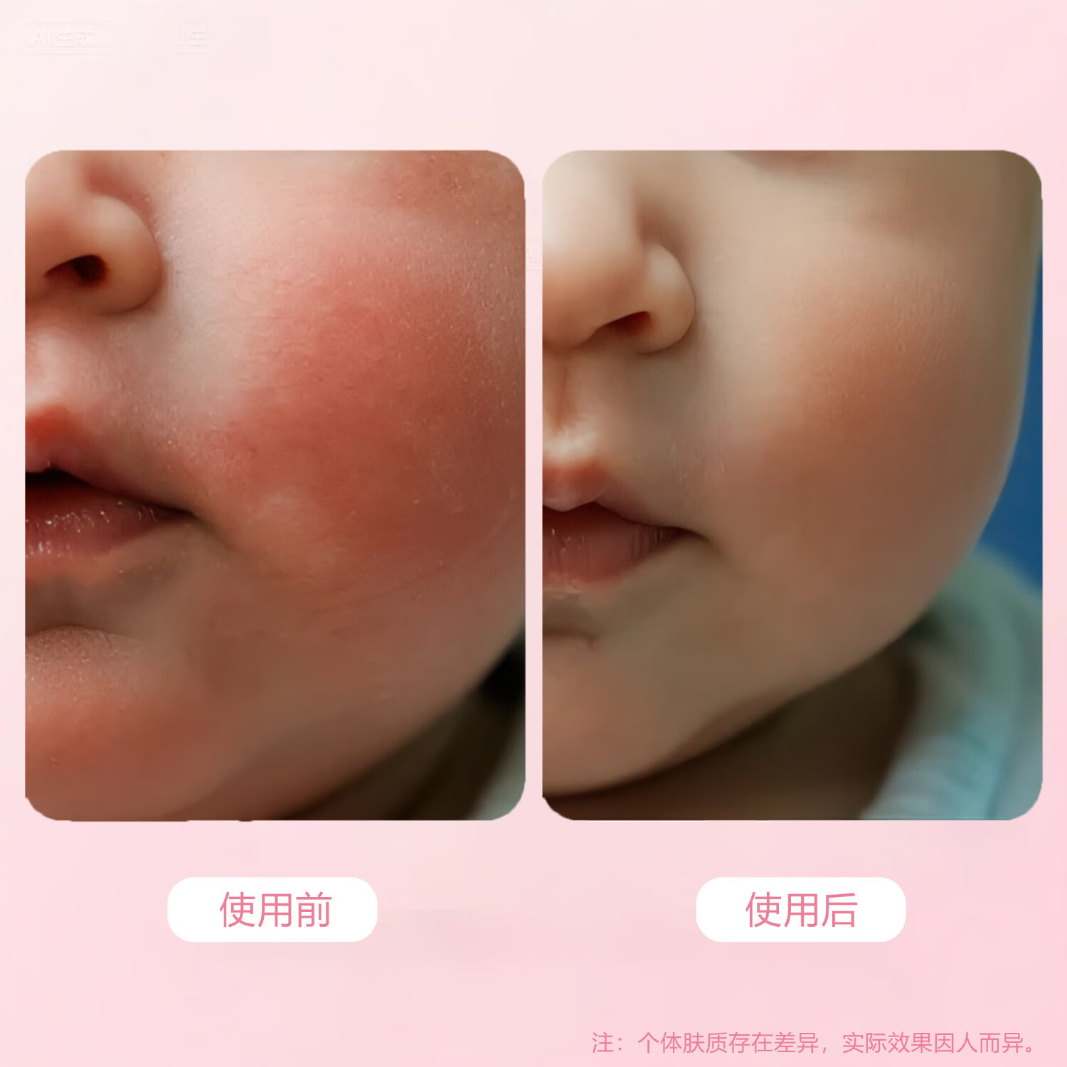 婴可思 【老配方】儿童面霜 宝宝保湿滋润霜 擦脸霜面霜儿童霜 【老配方】【三瓶超值装】