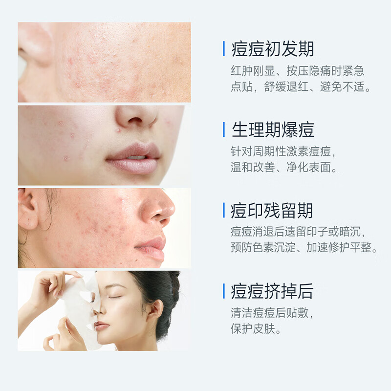 话肤HUAFU 清痘净肤修护贴面膜 祛痘减少粉刺保湿温和补水痘痘贴礼物 1盒送1片