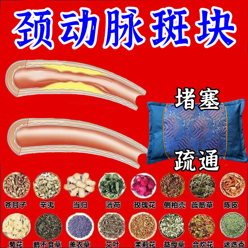 颈动脉斑块中药枕头动脉狭窄缺血硬化眩晕头晕脑梗塞供血不足草药 血管疏通【9999倍功效】血脂下降斑块消除