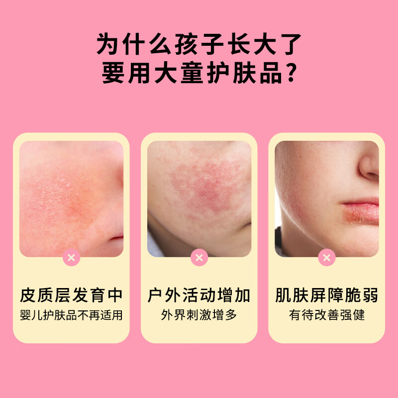 MUSE&FRIENDS儿童舒缓保湿面霜 大童轻盈补水滋润5-6岁以上宝宝润肤霜春夏季 四季通用 儿童舒缓保湿面霜50g【清爽版】