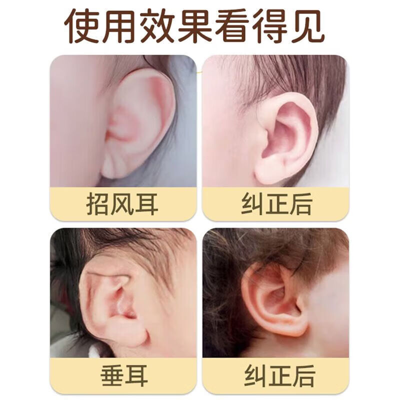 通用耳朵器婴儿硅胶耳朵器耳廓矫形新生儿畸形耳型垂耳纠正 耳撑[一对]+胶卷