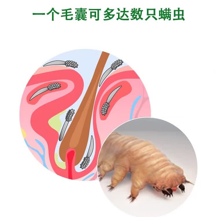 加视利加视利巾四松醇眼部清洁湿巾除螨虫14片装 4松油醇除螨湿巾 1片*14袋