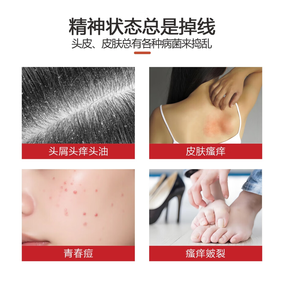 墨纯抑菌洗剂【品牌授权店】去屑止痒皮肤瘙痒抑菌清洁180ml赠2袋 红色