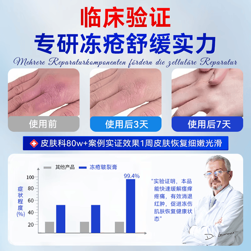 VADERNVA德国冻疮膏耳朵手足成人脸止痒冻伤膏消痛儿童男女士冻伤膏特效 三盒装【中重度】冻疮感染红肿出血