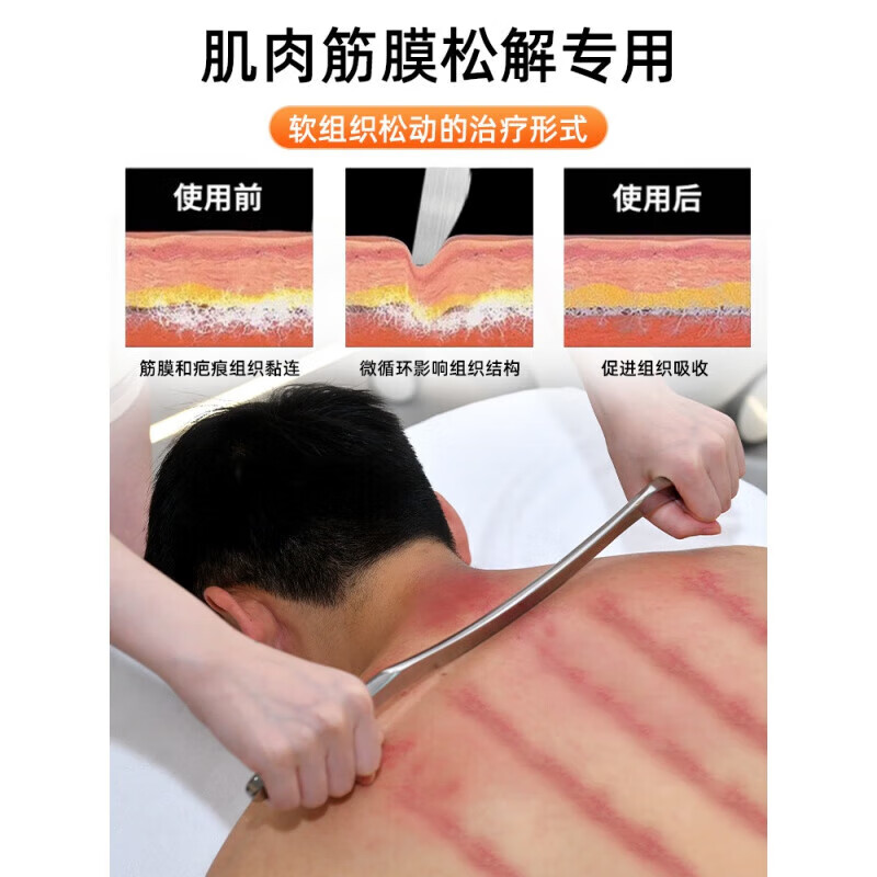 通用筋膜刀级筋膜刀医用不锈钢大M刀刮痧放松肌肉松解工具颈膜 小号M刀【适用手臂/腿部】长30cm/厚8mm