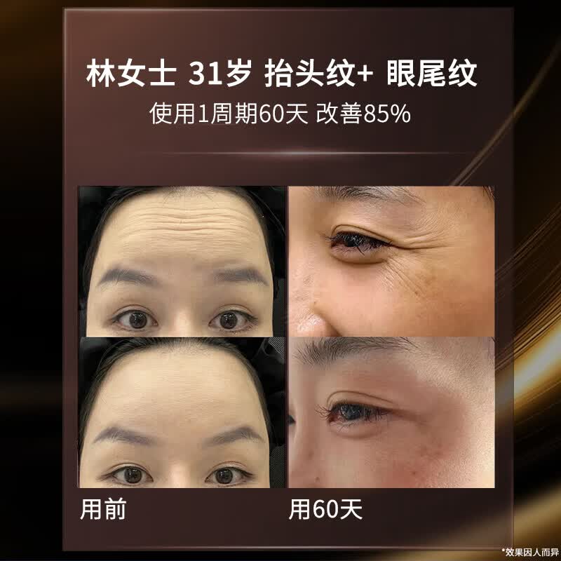 美颜坊重组胶原蛋白抗皱紧致面霜护肤品抗衰防老提拉皱纹保湿面霜专用肽 4瓶抗皱面霜【实惠装】