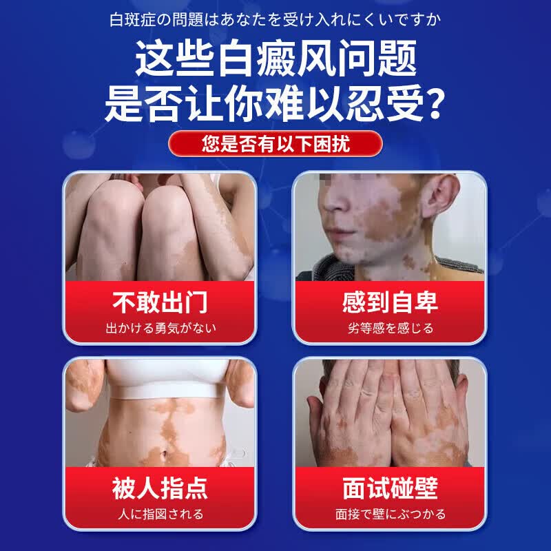 岩井昃弘日本进口白癜风药膏专用促进黑色素生长修复治白斑皮肤病遮盖液 特效买5送4【500%彻底冶裉】神奇 贝兰洁保健膏复方补骨脂酊医外用
