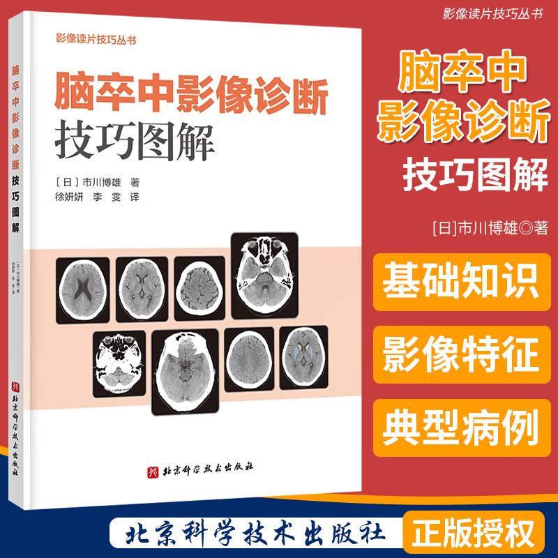 脑卒中影像诊断技巧图解 影像读片技巧丛书 北京科学技术出版社