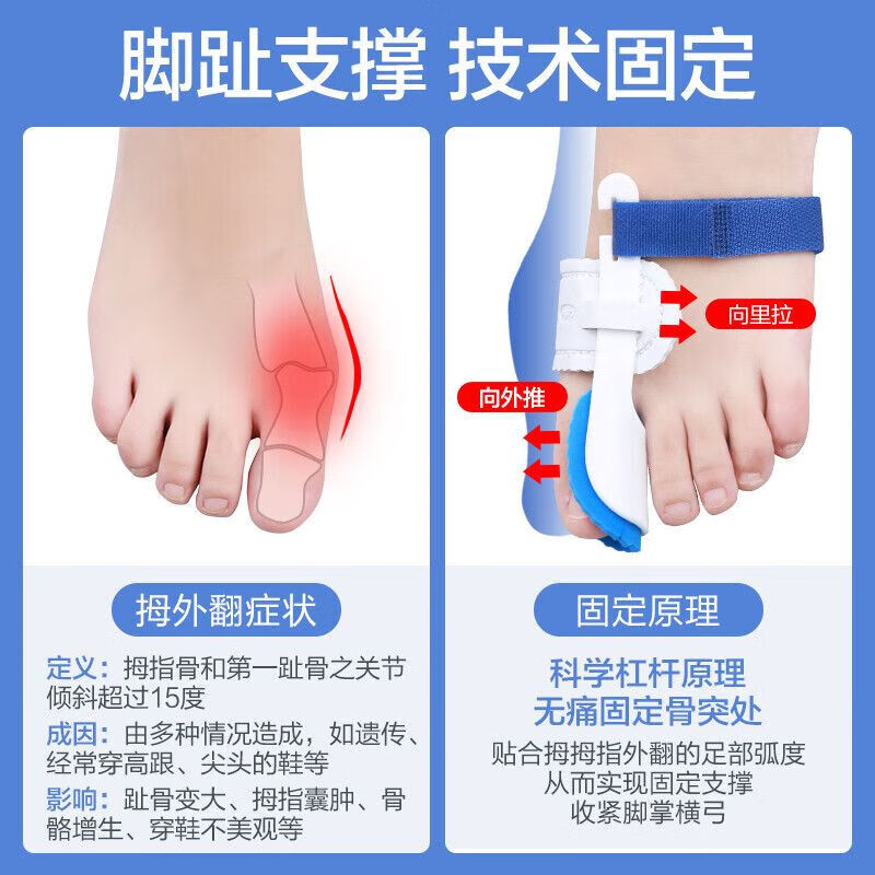 可孚拇指外翻器分大母脚趾头足改善纠正大脚骨分离可穿鞋男女 夜间固定款【一对装】