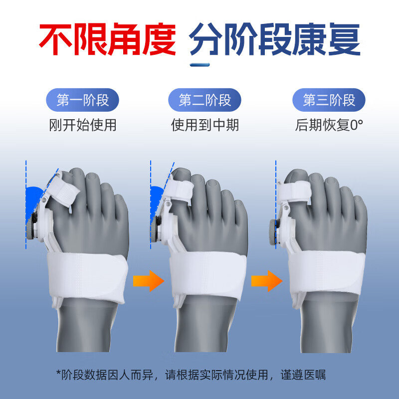 凯斯特拇指外翻矫正器脚趾内外翻矫正器专用拇外翻大拇指分趾器医用 【灰色一双】升级旋钮调节款 大脚趾拇外翻矫正器均码