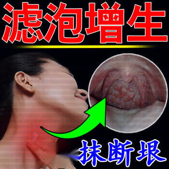淋巴滤泡增生声音嘶哑咽喉肿痛扁桃体肿大喉咙干痒咳嗽异物感 单盒装