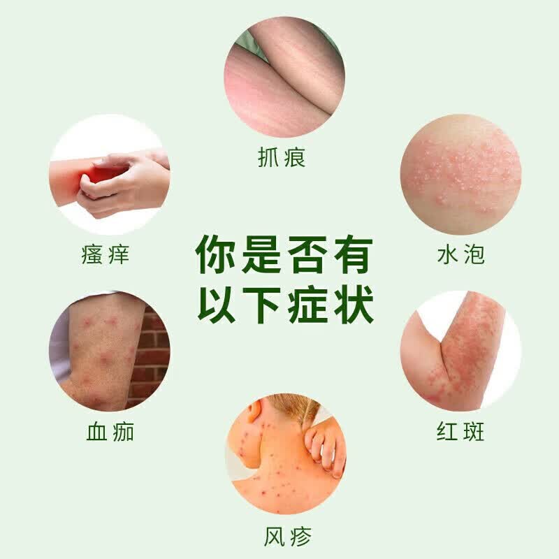 [丽珠]荆肤止痒颗粒 3g*10袋 1盒装 荆肤止痒颗粒荨麻疹专用国药正品止痒抑菌皮肤瘙痒身体痒荨麻疹湿疹进口服止痒去过敏 荨麻疹皮肤瘙痒止痒用药