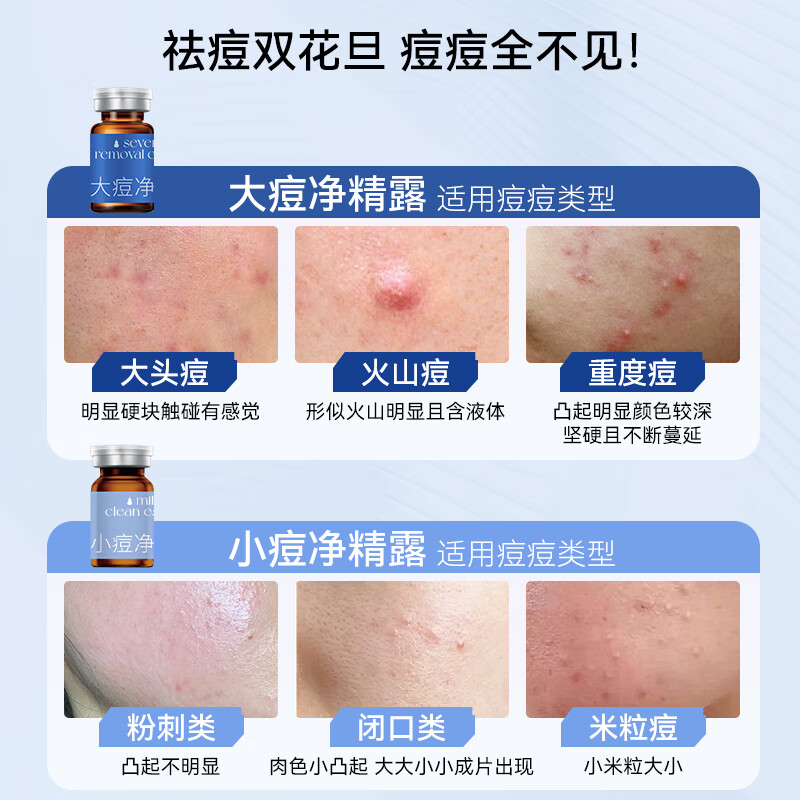 泽平大/小痘净精露草本祛痘精华液控油熬夜姨妈痘粉刺闭口黑头 小痘净5只装送正装洁面+小痘净2支