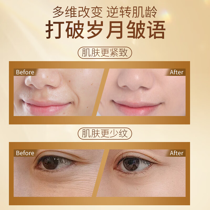 NCCU灵参胶原动能逆龄肌活淡纹紧致爽肤水乳液组合水润嫩滑护肤品 120ml(爽肤水)