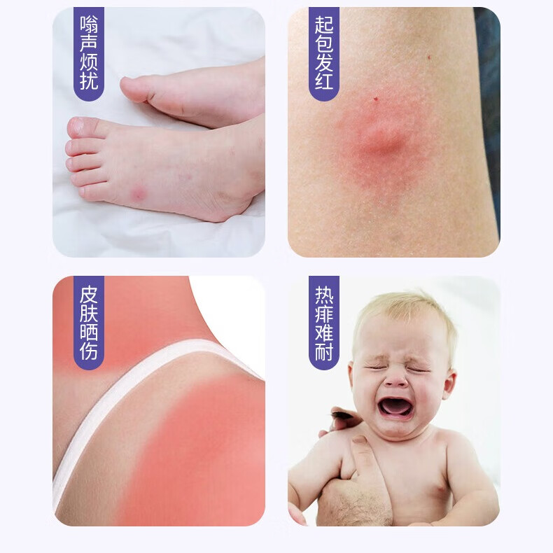 葵花紫草膏 婴幼儿专用止痒膏儿童宝宝蚊子虫子叮咬清凉舒缓户外驱蚊 4盒便携涂抹【30g/盒】