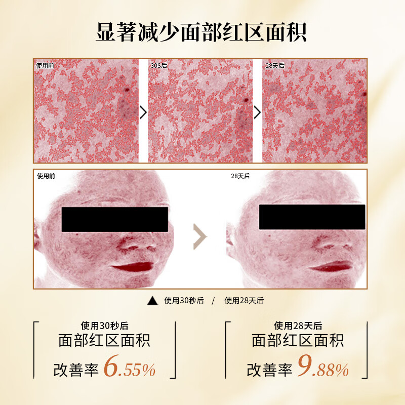 贝肤瑞多重修护霜敏感肌用保湿修护舒缓泛红维稳屏障改善换季干敏 咨询客服或详情页领取优惠券