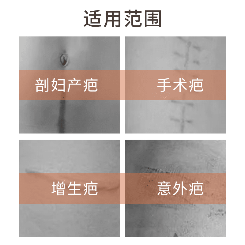 丽森卡疤痕贴剖腹产疤痕贴增生凸起去除疙瘩 一盒装(3贴)