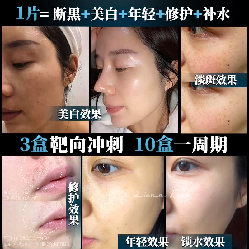 小野拓司第2代特证版断黑面膜 断黑美白去黄淡斑抗老救松垮红敏 1盒·初体验【第2代升级·特证版】