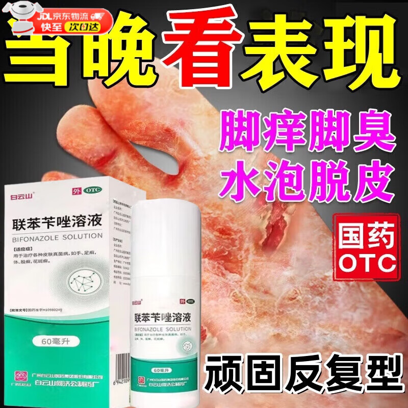 聯(lián)苯芐唑溶液噴霧去腳氣噴劑治腳氣藥止癢脫皮爛腳丫真菌感染根正品治腳氣腳臭的藥治香港腳皮膚用藥 5盒【告別反復嚴重腳氣 】